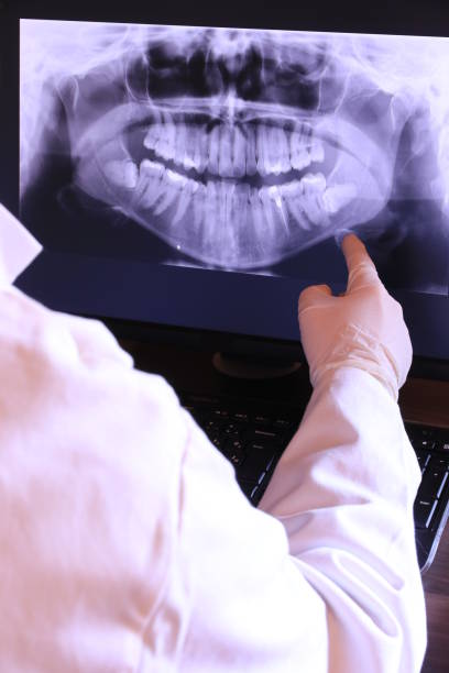 Best Broken or Cracked Tooth Emergency Dentist in Weaverville, NC