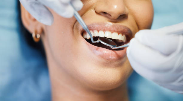 Best Emergency Dentist for Lost Fillings or Crowns in Weaverville, NC