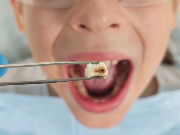 Best Urgent Dental Care for Toothache in Weaverville, NC