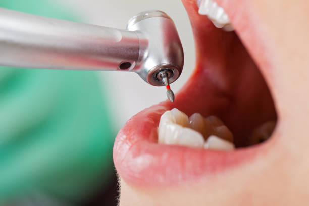 Best Emergency Dentist for Knocked-Out Tooth in Weaverville, NC